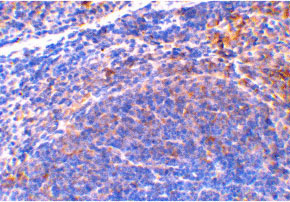 2 - Smac Antibody ASC10133