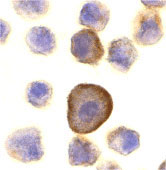 8 - PERP Antibody ASC10141