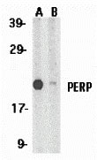 1 - PERP Antibody ASC10141