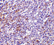 2 - TCCR Antibody ASC10146