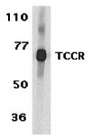 1 - TCCR Antibody ASC10146
