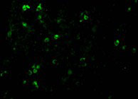 3 - TCCR Antibody ASC10147