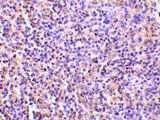 2 - TCCR Antibody ASC10147