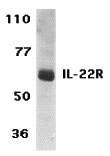 1 - IL-22 Receptor Antibody ASC10148