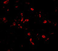 3 - CIKS Antibody ASC10153