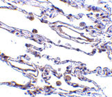 2 - CIKS Antibody ASC10153