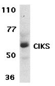 1 - CIKS Antibody ASC10153