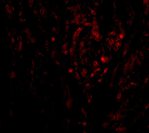 3 - CIKS Antibody ASC10154