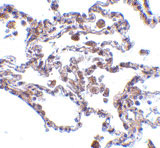 2 - CIKS Antibody ASC10154