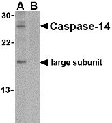 1 - Caspase-14 Antibody ASC10156