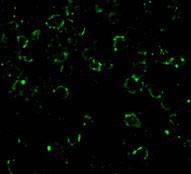3 - CARD10 Antibody ASC10164