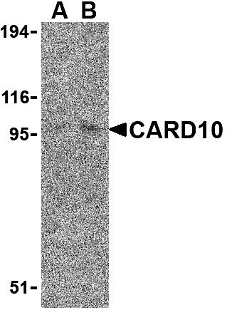 1 - CARD10 Antibody ASC10164