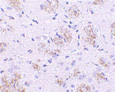 2 - KLHL1 Antibody ASC10165