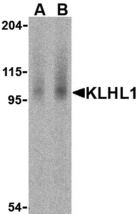 1 - KLHL1 Antibody ASC10165