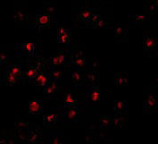 3 - ILP-2 Antibody ASC10166