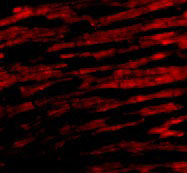 3 - Bcl-rambo Antibody ASC10167