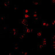 3 - AATF Antibody ASC10174