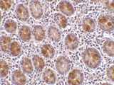 2 - AATF Antibody ASC10174