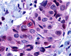 2 - PUMA Antibody ASC10176