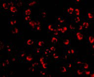 3 - PAK5 Antibody ASC10182