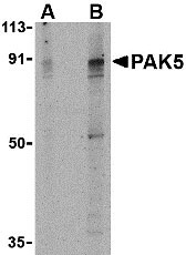 1 - PAK5 Antibody ASC10182