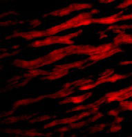 3 - TIRAP Antibody ASC10200
