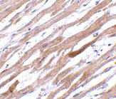 2 - TIRAP Antibody ASC10200