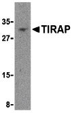 1 - TIRAP Antibody ASC10200