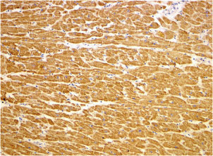 2 - TIRAP Antibody ASC10201