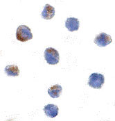 8 - PARC Antibody ASC10204