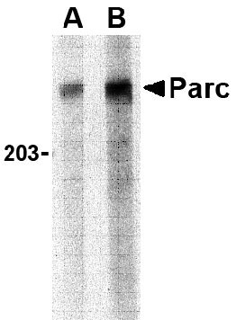 1 - PARC Antibody ASC10204