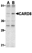 1 - CARD8 Antibody ASC10206