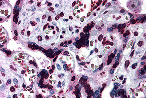 2 - CARMA2 Antibody ASC10208