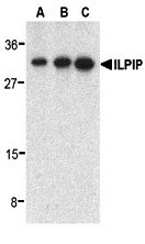 1 - ILPIP Antibody ASC10213