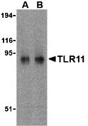1 - TLR11 Antibody ASC10233