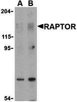 1 - Raptor Antibody ASC10310