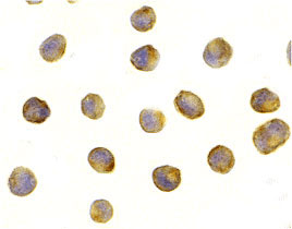8 - Raptor Antibody ASC10311