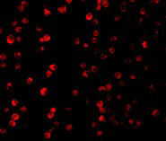 3 - Raptor Antibody ASC10311