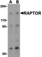 1 - Raptor Antibody ASC10311