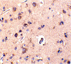 2 - CTRP2 Antibody ASC10334