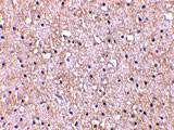 2 - CTRP5 Antibody ASC10339
