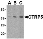 1 - CTRP5 Antibody ASC10340