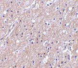 2 - CTRP6 Antibody ASC10342