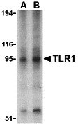 1 - TLR1 Antibody ASC10369