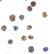 8 - IRE1p Antibody ASC10377