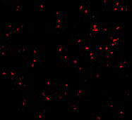 3 - IRE1p Antibody ASC10377