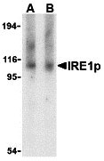 1 - IRE1p Antibody ASC10378