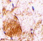 2 - IL-31 Antibody ASC10397