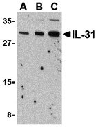1 - IL-31 Antibody ASC10397