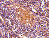 2 - AIM Antibody ASC10419
